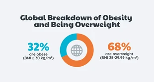 Free  Template: Global Breakdown Of Obesity Chart Template