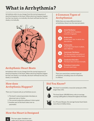 Free  Template: Arrhythmia Infographic Template